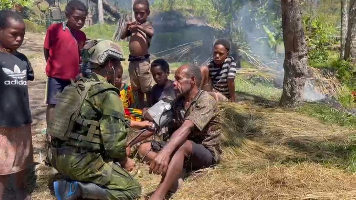 Sentuhan TNI untuk Warga Pegunungan: Satgas Yonif 700/WYC Pos Kout Sinak Gelar Pelayanan Kesehatan Gratis di Kampung Misi